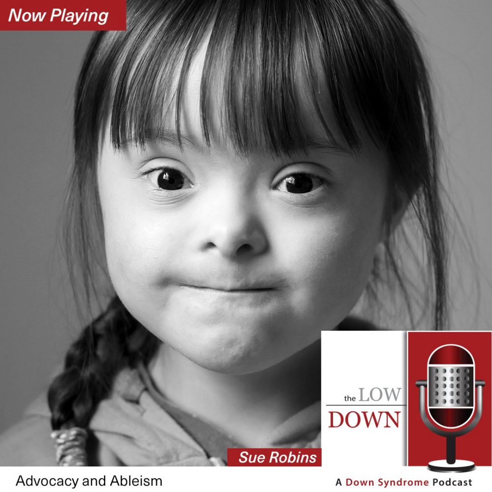 Girl with Down syndrome looking exasperated