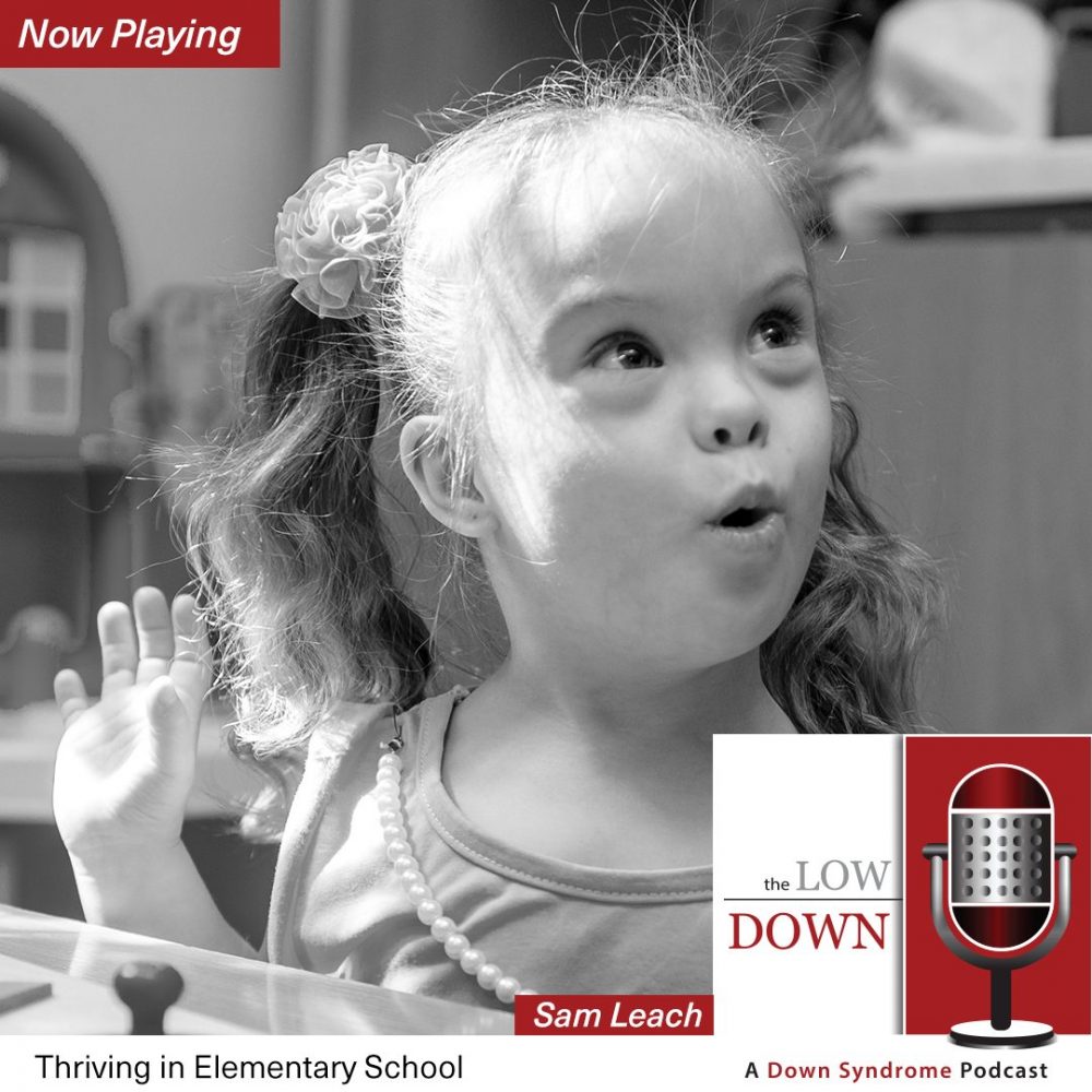 Girl with Down syndrome expresses surprise in classroom