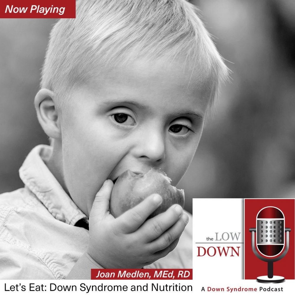 Young boy with Down syndrome eating apple