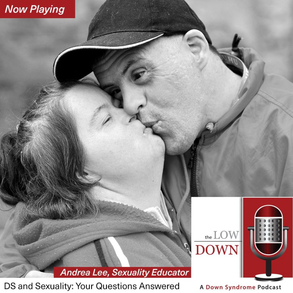 Couple with Down syndrome kissing