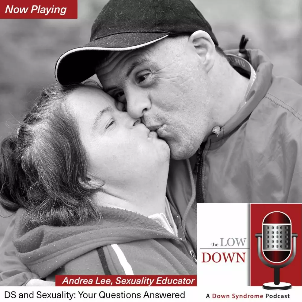 Couple with Down syndrome kissing